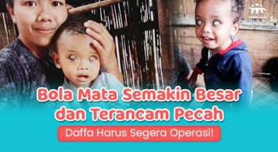 Terancam Buta Total! Tolong Daffa dari Tumor Mata