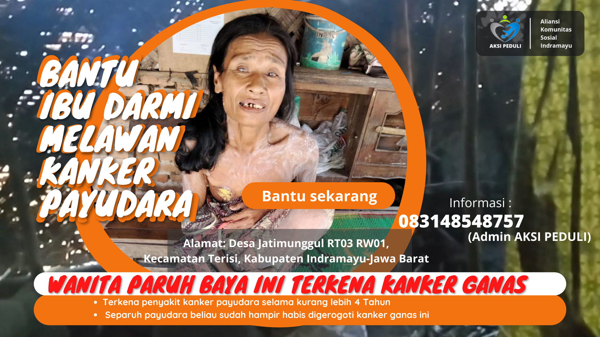 Bantu Ibu Darmi melawan kanker payudara ganas