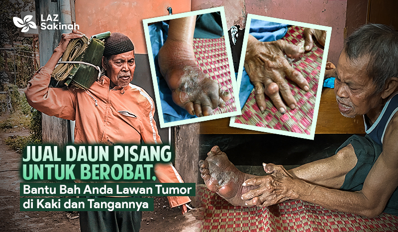 Bantu Bah Anda Penjual Daun Pisang Sembuh dari Tumor