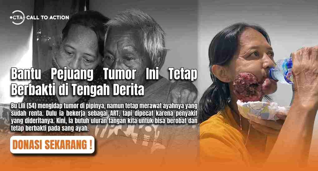 Sembuhkan Tumor Ganas Yang Menggerogoti Pipi Bu Lili