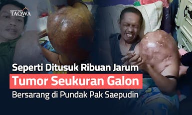 Sudah Kronis, Bantu Pak Saepudin Sembuh dari Tumor Tulang