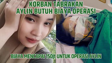 Alami Patah Tulang dan Kerusakan Wajah akibat Kecelakaan, Aylin Butuh Pertolonganmu Segera!