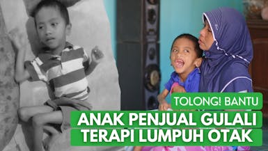 Bantu anak Penjual Gulali Terapi Lumpuh Otak