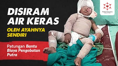 Patungan Bantu Biaya Pengobatan Putra