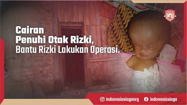 Gawat!! Cairan Semakin Penuhi Otak Bayi Rizki