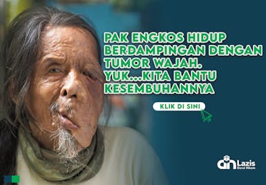 Pak Engkos Hidup Berdampingan dengan Tumor Wajah, Yuk Kita Bantu Kesembuhannya