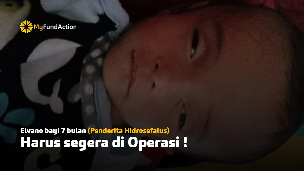 Bantu Anak Guru Honorer Bisa Segera Operasi Otak