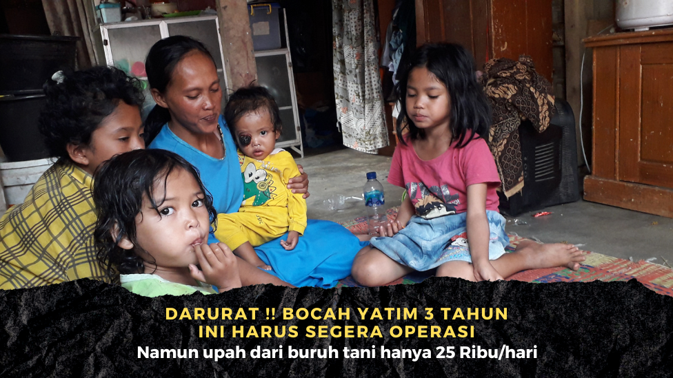 Idap Kanker Mata, Bantu Anak Buruh Tani Ini Bisa Lakukan Pengobatan