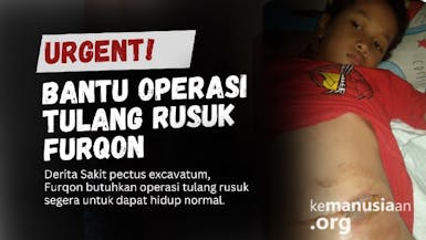 Urgent: Derita Pectus Exavatum, Bantu Furqon Operasi Tulang Rusuk Segera