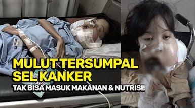 Tolong! Bantu Putri Lekas Operasi untuk Selamat