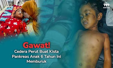 Gawat! Perut Chelsea (6th) Bengkak karena Kista Pankreas
