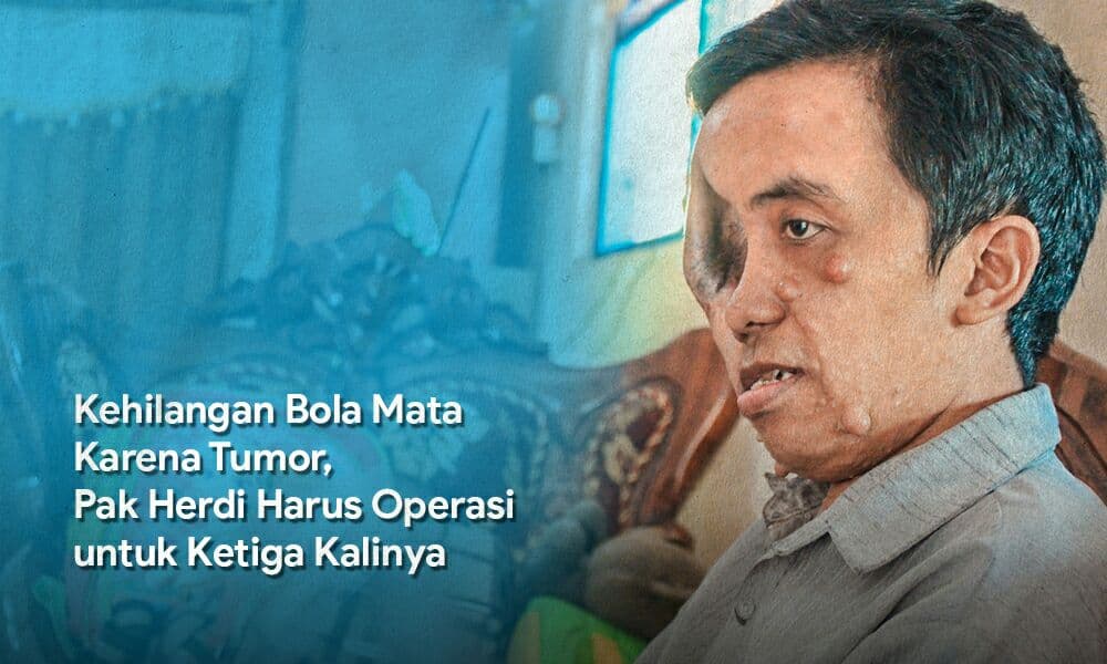 Tumor Telah Renggut Mata Kanan Pak Herdi