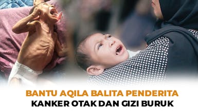 Bantu Aqila Balita yang mengidap Kanker Otak dan Gizi Buruk