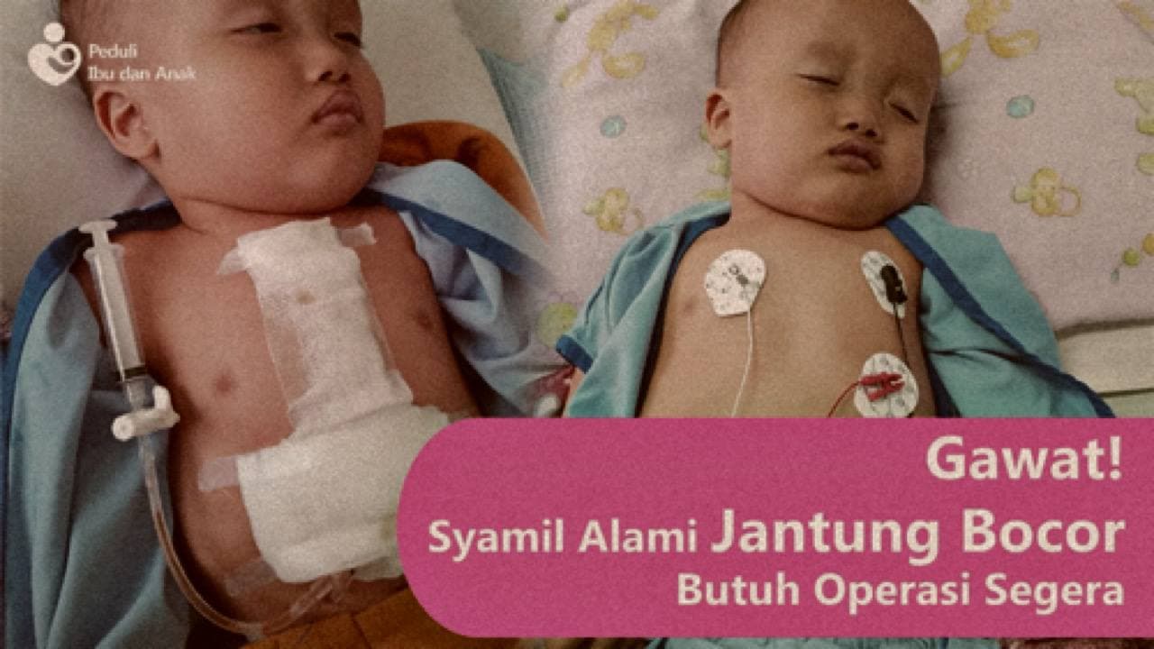 Operasi Katerisasi & Bedah Jantung untuk Syamil