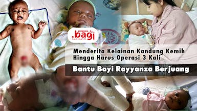 Menderita Penyakit Langka Sejak Lahir, Bantu Adik Rayanza Sembuh