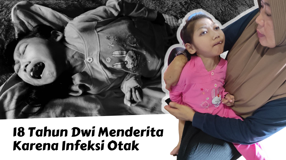 BANTU DWI YANG INFEKSI OTAK