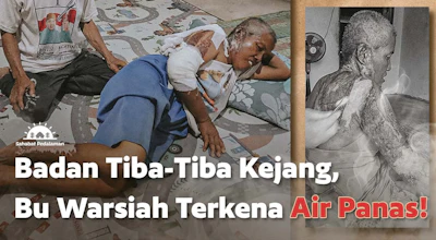 Bu Warsiah Terkena Luka Bakar Parah Akibat Epilepsi!