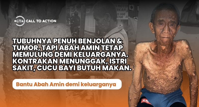 Tolong Abah Amin! Kondisinya Memburuk, Tubuhnya Dipenuhi Benjolan & Tumor