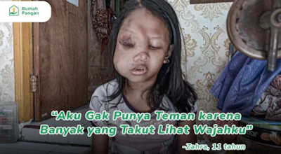 Bantu Pengobatan Zahra