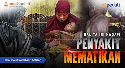 Masa Kecil Hafizan Direnggut Penyakit Pneumonia Akut