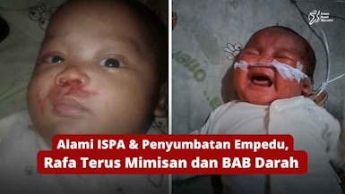 Terlahir Prematur, Selamatkan Rafa dari Kelainan Jantung dan Komplikasi