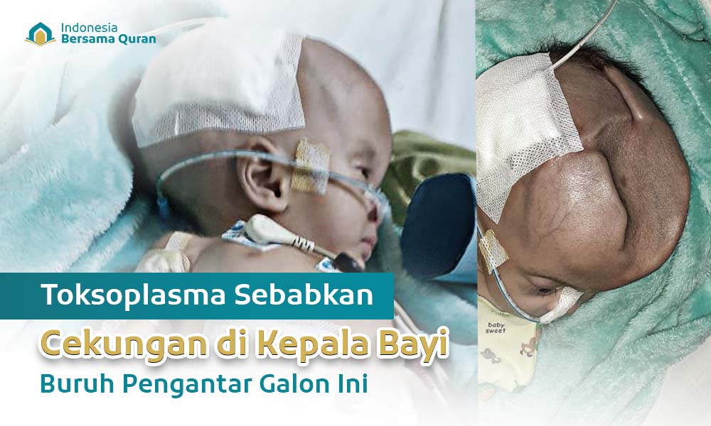 Selamatkan Nyawa Dik Aisyah dari Hidrosefalus