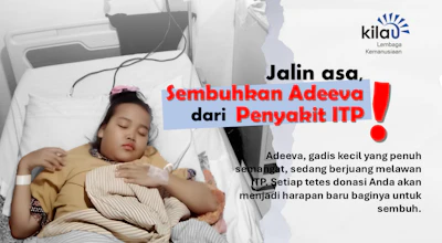 Terkena autoimun diusia belia, Adeeva Naura butuh uluran tangan kita!