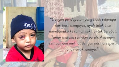 SEMBUHKAN MATA DAFFA