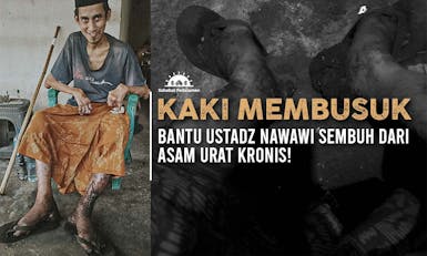 Divonis Lumpuh dan Harus Operasi Ginjal, Ustadz Nawawi Harus Segera Berobat!