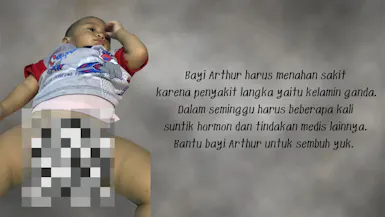 PUNYA 2 KELAMIN, BANTU BAYI ARTUR OPERASI