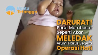 Darurat! Perut Membesar Seperti Akan Meledak, Arumi Harus Segera Operasi Hati