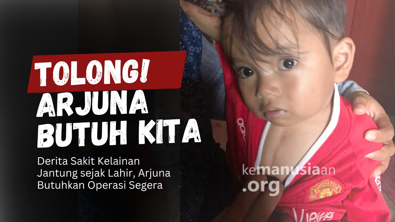 URGENT Sakit Jantung Bawaan Sejak Lahir, Arjuna Butuh Tindakan Medis