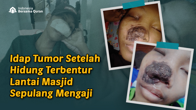Bantu Dik Suratno (14 thn) Operasi Tumor Hidung