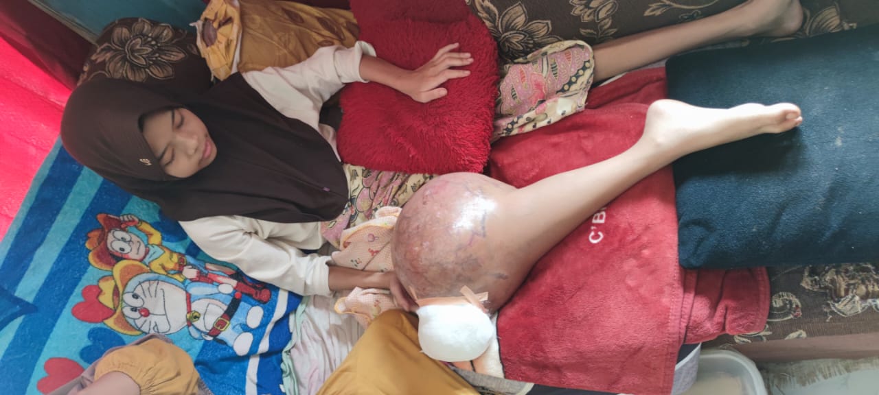 tidak kurang dari 1 tahun, adik Nabila anak Yatim ingin sembuh