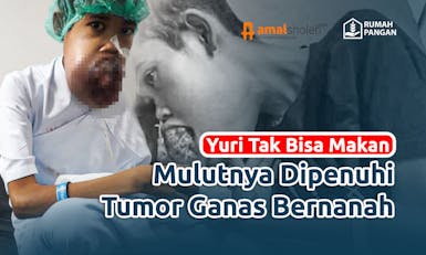 Bantu Yuri, Yatim yang Berjuang Lawan Tumor Ganas di Mulut