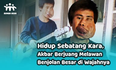 Kasihan! Sudah Bertahun-Tahun Wajah Pengamen Ini Membengkak dan Sakit