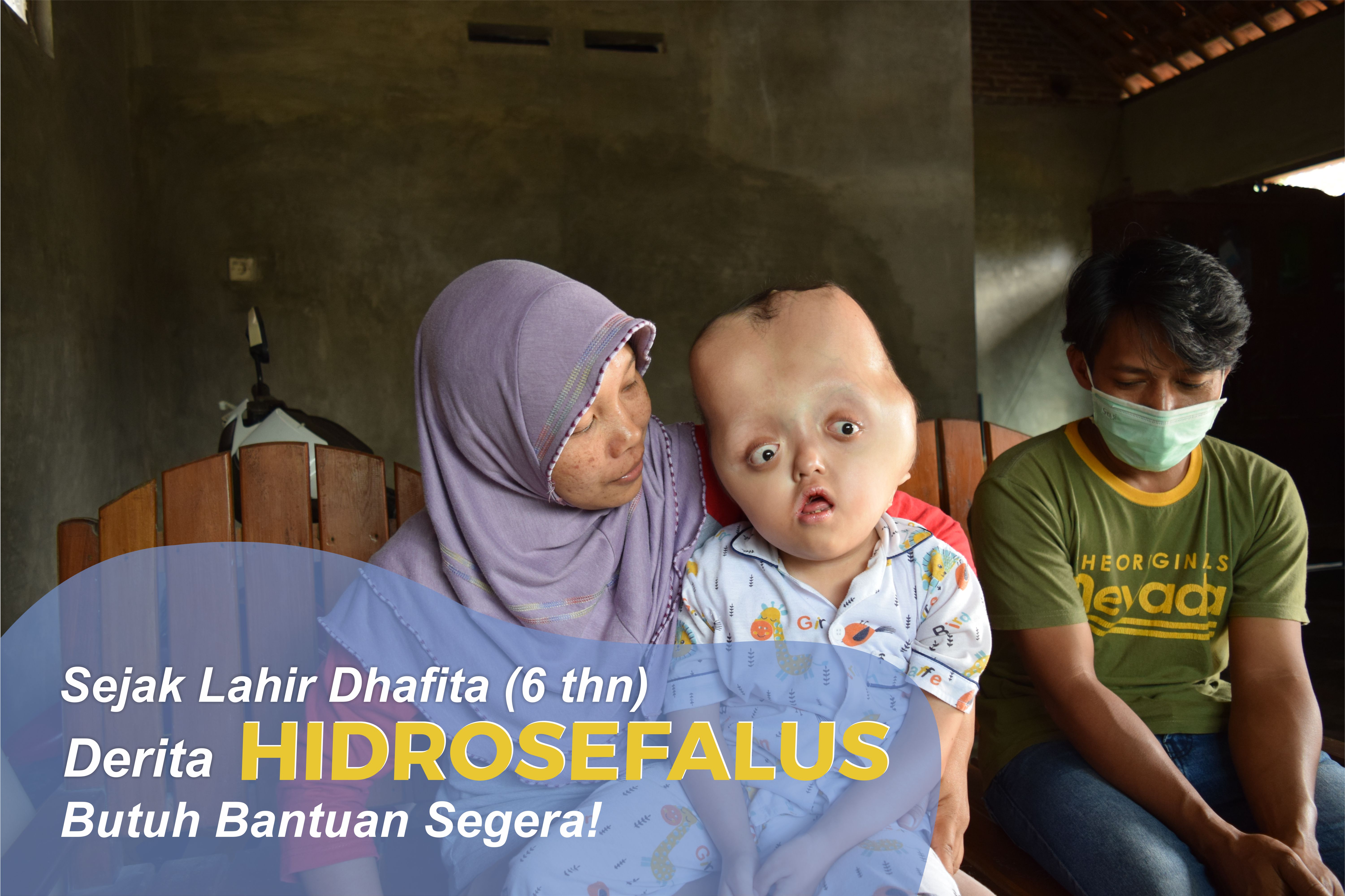 Bantu Dhafita Sembuh dari Hidrosefalus Kronis