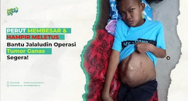 Perut Membesar dan Hampir Meletus, Bantu Santri ini (Jalaluddin) Operasi Tumor Ganas Segera!