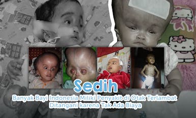 Selamatkan Bayi Indonesia dari Penyakit Otak Langka