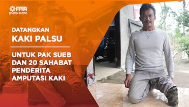 Datangkan Kaki Palsu Untuk Pak Sueb Dan 20 Sahabat Penderita Amputasi Kaki