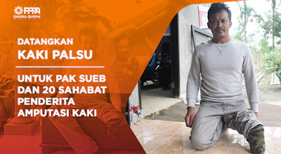 Datangkan Kaki Palsu Untuk Pak Sueb Dan 20 Sahabat Penderita Amputasi Kaki