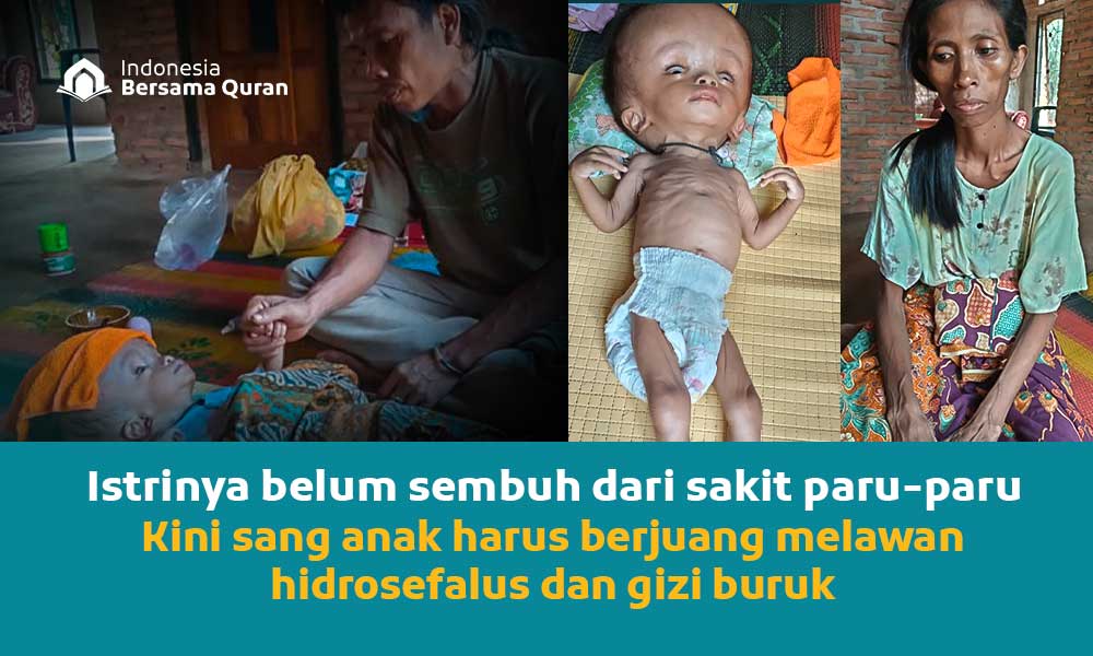 Bersamai Perjuangan Pak Suherman Sembuhkan Istri dan Anaknya