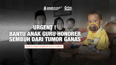URGENT! Bayi Guru Honorer Derita Tumor Ganas Di Mulutnya!