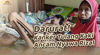 Selamatkan Nyawa Rizal dari Kanker Tulang Ganas
