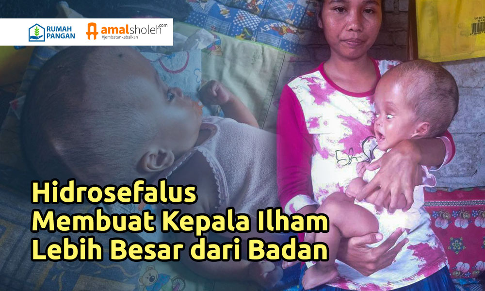 Bantu Ilham Berjuang Lawan Hidrosefalus
