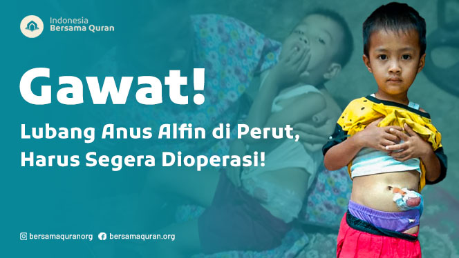 Urgent! Bantu Operasi Lubang Anus Alfin