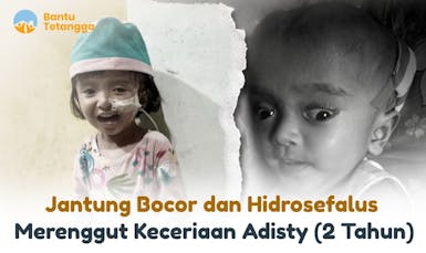 Adisty Butuh Operasi Atasi Jantung Bocor dan Hidrosefalus