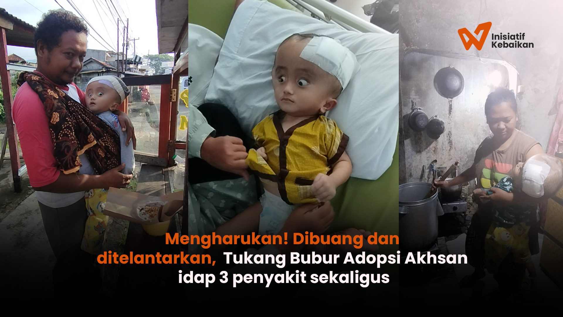 Idap 3 Penyakit, Tukang Bubur Adopsi Anak Kepala Besar Mal Nutrisi