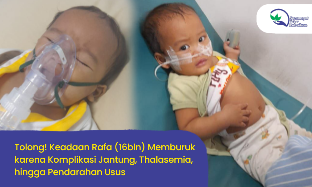Bayi 16 Bulan Ini Alami Komplikasi Penyakit hingga Sesak dan Muntah Darah!