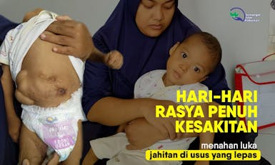 Di Usia belianya, Rasya harus berjuang melaswan Hernia
